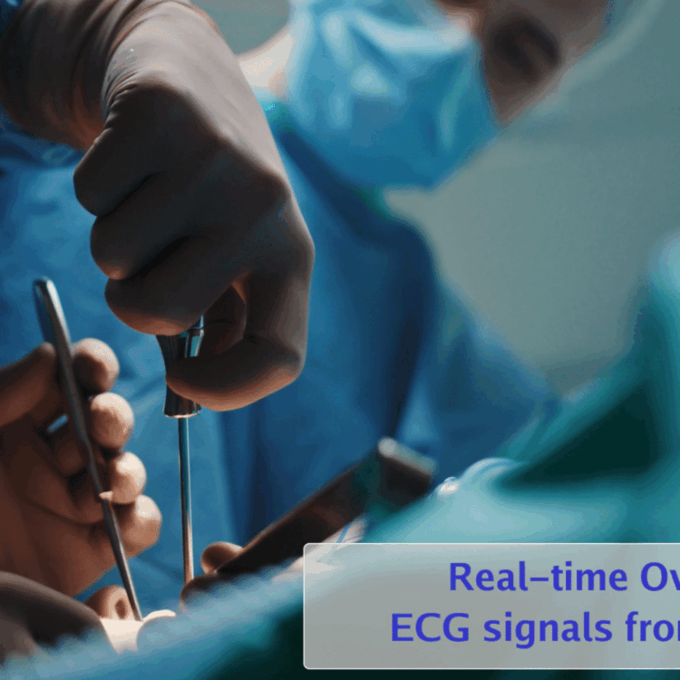 Video of Operation Taking Place with Dynamic Overlays showing patient information and Picture-In-Picture an Electrocardiograph input on the second SDI input